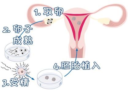 全球医疗